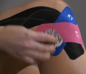 KT tape treating knee injury